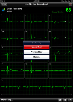 Wireless ECG Machine
