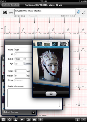 Medical Wireless ECG Monitoring Device For Resting Electrocardiogram Test