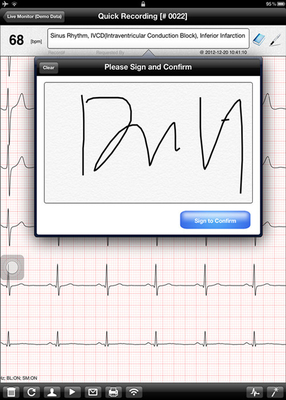 Medical Wireless ECG Monitoring Device For Resting Electrocardiogram Test