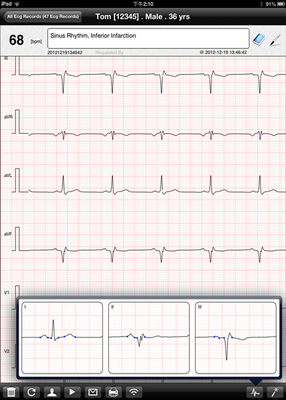 Wireless 12 channel Portable Rest ECG Recorder , Digital ECG Machine