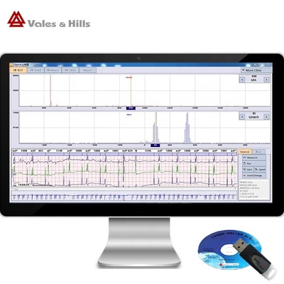 মিনি রেকর্ডার হোয়াইট রঙের সঙ্গে পেশাদারী Ecg Holter অ্যাম্বুলেটর মনিটরিং ডিভাইস